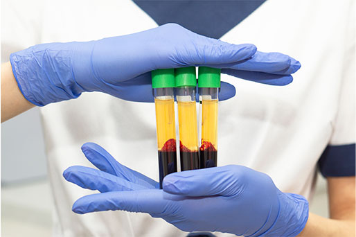 patient getting prp therapy for joint pain relief in Monroeville